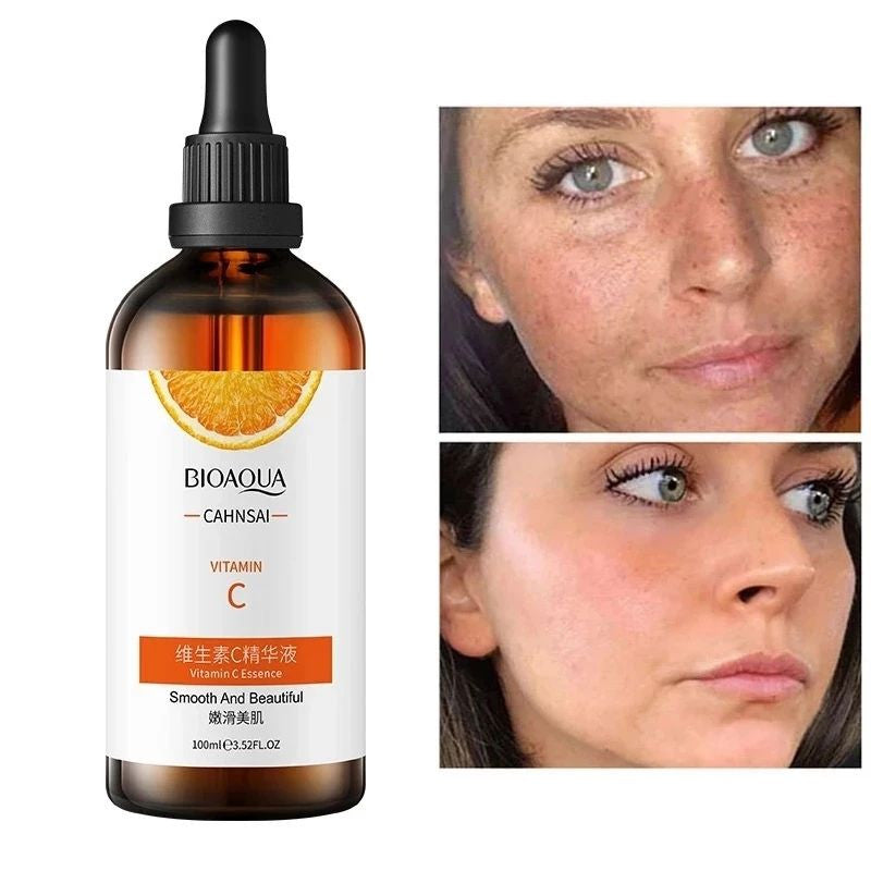 COMBO COMPLETO X 5 PRODUCTOS VITAMINA C